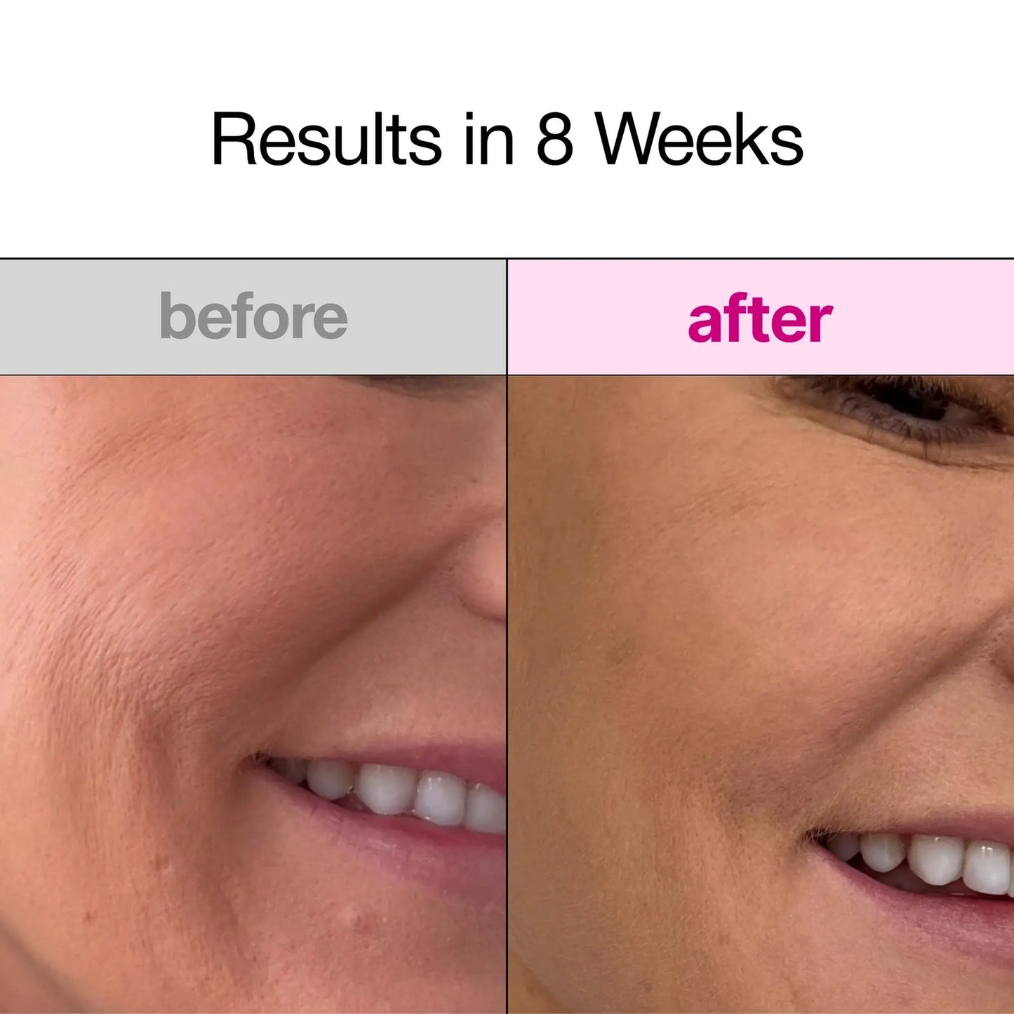 Overnight Bio-Collagen Face Mask