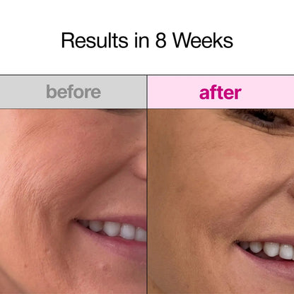 Overnight Bio-Collagen Face Mask